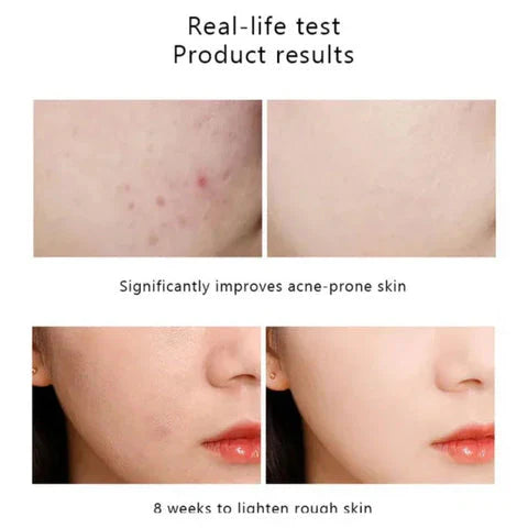 The Ordinary Niacinamide 10% + Zinc 1% - 30ml