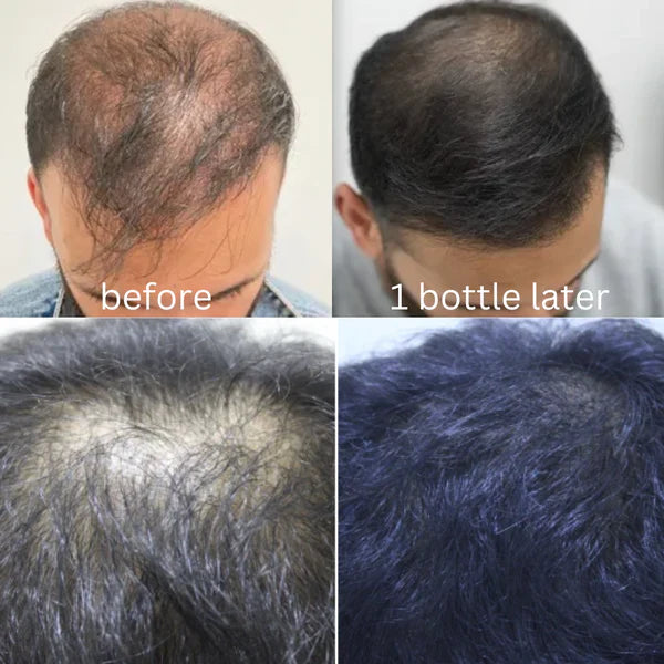 Zeva Harbal Magical Hair Oil (💯Guaranteed Visibal Results)